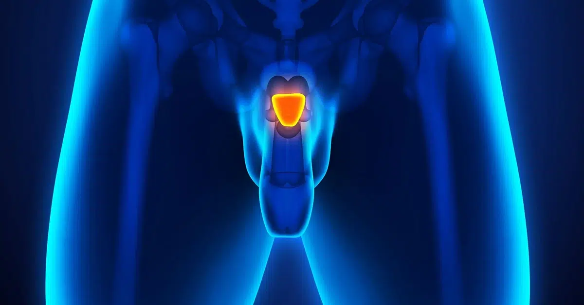 Vorteile des Prostata MRT | GARMER Radiologie Podcast